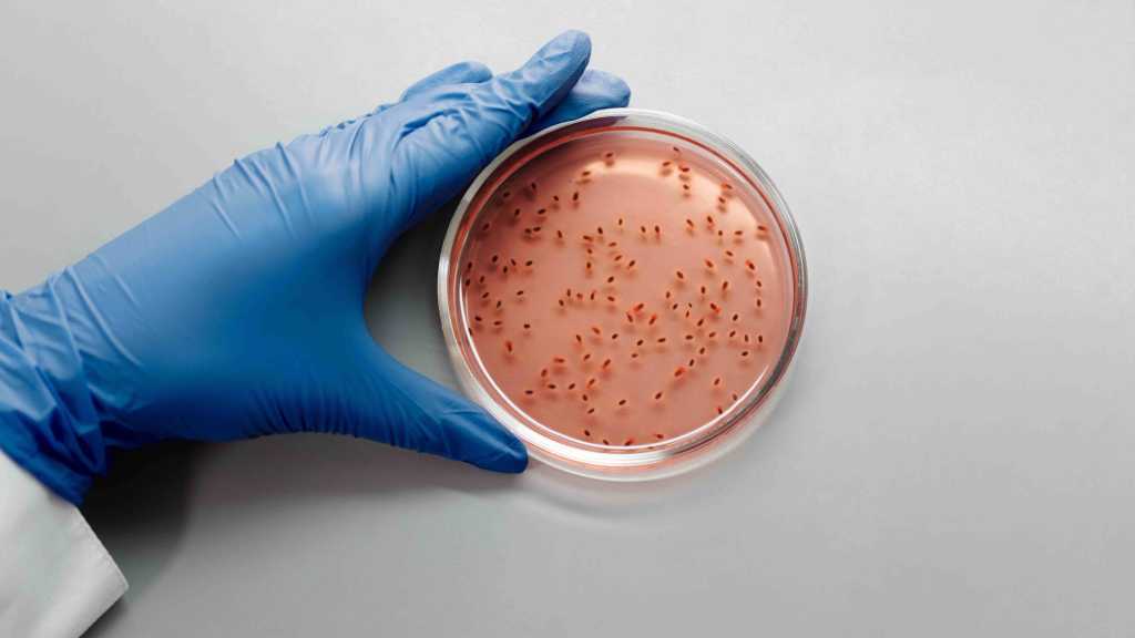 Qu'est-ce que le microbiote intestinal et quel est son rôle dans l'organisme ?