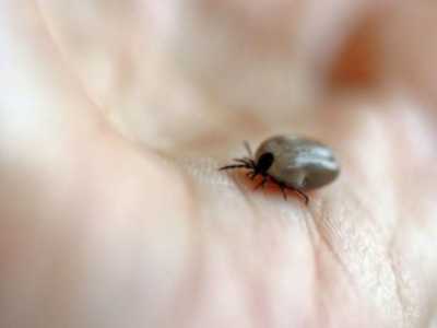 Tout savoir sur la maladie de Lyme